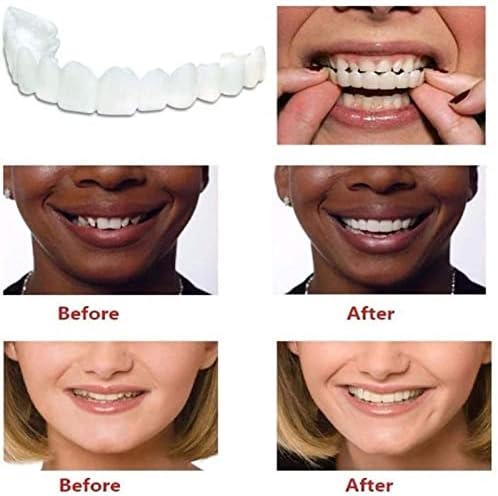 ОТЦПП протези заби привремени ， лажни заби, 2 компјутери од фурнири заби за жени и мажи - природа и удобно
